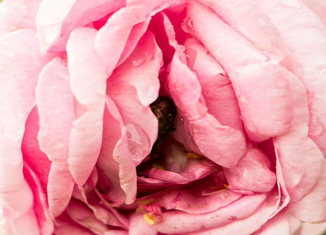 تزریق چربی به واژن شیراز