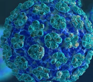 درمان زگیل تناسلی در شیراز